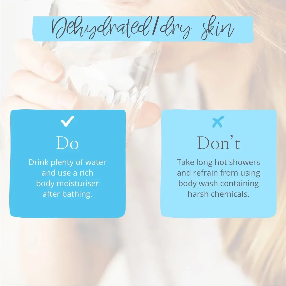 dry and dehydrated skin tips
