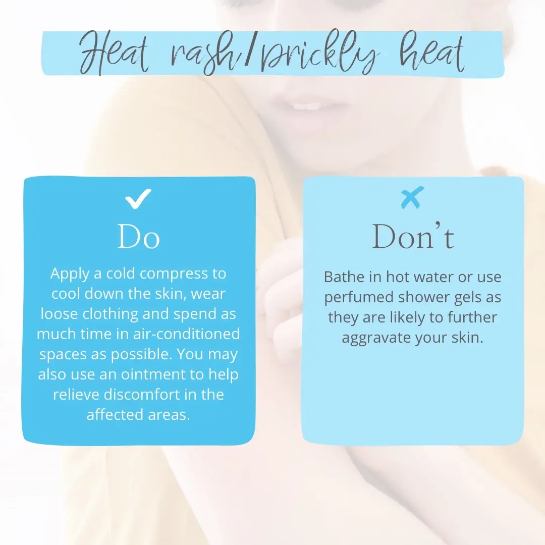 tips for treating heat rash and prickly heat
